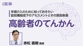 高齢者のてんかん